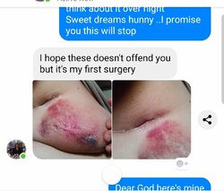 Norma's tumor bags.jpg Norma's tumor bags.jpg