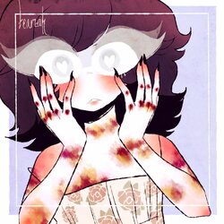 bloody_knuckles_and_bruises__oh_my__by_dollieguts_d7pcdcf-fullview.jpg bloody_knuckles_and_bruises__oh_my__by_dollieguts_d7pcdcf-fullview.jpg