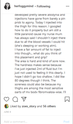 Screenshot_2020-08-22 Frankie's ( herfoggymind) Instagram profile • 6,437 photos and videos(19).png Screenshot_2020-08-22 Frankie's ( herfoggymind) Instagram profile • 6,437 photos and videos(19).png