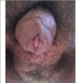Capture.PNG Capture.PNG