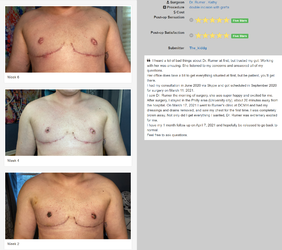 nips.png nips.png