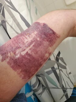 ArmHorror1.jpg ArmHorror1.jpg