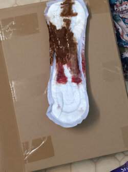 Poop_vagina_pad2.jpg Poop_vagina_pad2.jpg