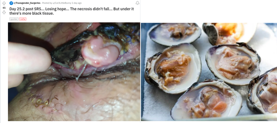 Amhole on the Half Shell.png Amhole on the Half Shell.png