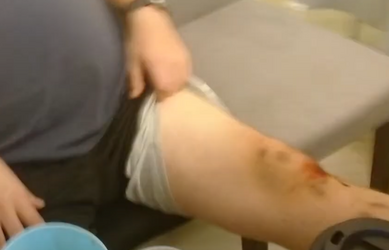 knee.png knee.png