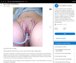 Amhole_stent1.jpg Amhole_stent1.jpg
