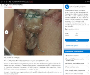 Amhole_stent2.jpg Amhole_stent2.jpg