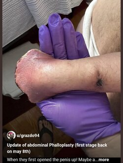 splay penis.jpg splay penis.jpg