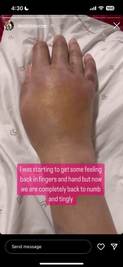 danis-hand-is-numb-and-she-has-a-busy-week-v0-gmv7mqk4kijc1.jpg danis-hand-is-numb-and-she-has-a-busy-week-v0-gmv7mqk4kijc1.jpg