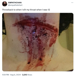 neckwound.PNG neckwound.PNG