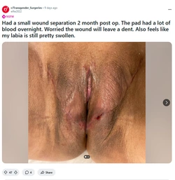 Camel_toe_troon2.jpg Camel_toe_troon2.jpg