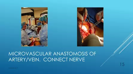 Santucci-Complications_of_Phalloplasty_Fried_Symposium_2019_015.jpg Santucci-Complications_of_Phalloplasty_Fried_Symposium_2019_015.jpg