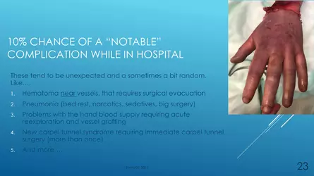 Santucci-Complications_of_Phalloplasty_Fried_Symposium_2019_023.jpg Santucci-Complications_of_Phalloplasty_Fried_Symposium_2019_023.jpg