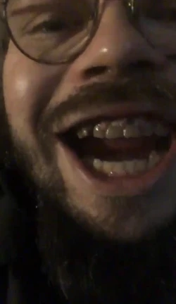 teef.jpg teef.jpg