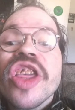 teef4.jpg teef4.jpg