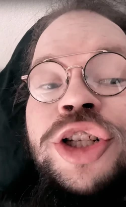 teeth3.jpg teeth3.jpg