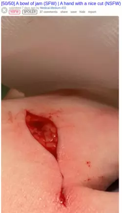gore.png gore.png