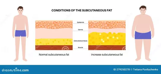 obesity-fat-level-conditions-subcutaneous-human-body-cellulite-concept-excess-insufficient-di...webp obesity-fat-level-conditions-subcutaneous-human-body-cellulite-concept-excess-insufficient-di...webp