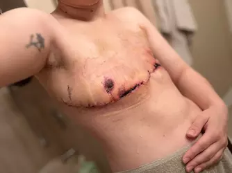 am-i-the-only-one-that-looks-like-this-post-op-v0-dc54rddx5iye1.webp am-i-the-only-one-that-looks-like-this-post-op-v0-dc54rddx5iye1.webp