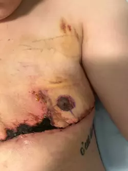 am-i-the-only-one-that-looks-like-this-post-op-v0-4b3f0edx5iye1.webp am-i-the-only-one-that-looks-like-this-post-op-v0-4b3f0edx5iye1.webp