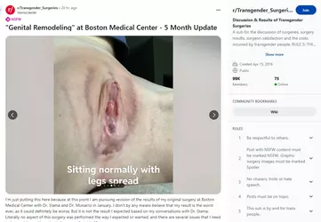 Veinscrawler04.webp Veinscrawler04.webp