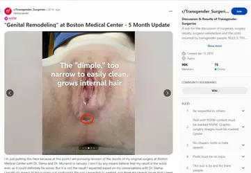 Veinscrawler08.webp Veinscrawler08.webp