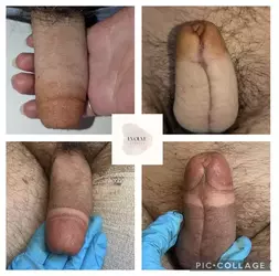 no-glandplasty-created-3d-glans-with-tattoo-v0-64myvoxvk85f1.webp no-glandplasty-created-3d-glans-with-tattoo-v0-64myvoxvk85f1.webp