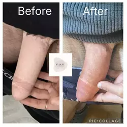 before-and-after-added-some-freckles-for-detail-on-penis-v0-ch6bhzkrtf3f1.webp before-and-after-added-some-freckles-for-detail-on-penis-v0-ch6bhzkrtf3f1.webp
