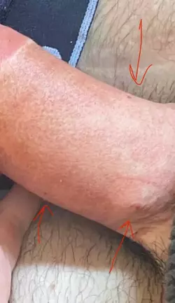 before-and-after-added-some-freckles-for-detail-on-penis-v0-l91tuykrtf3f1.webp before-and-after-added-some-freckles-for-detail-on-penis-v0-l91tuykrtf3f1.webp