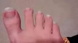 toenailsjet1.webp toenailsjet1.webp