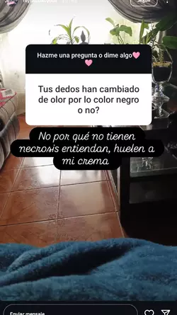 nonecrosis.webp nonecrosis.webp