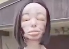 rotten cheek2.png rotten cheek2.png