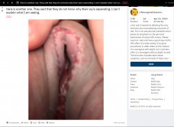Axe_wound_literally.jpg Axe_wound_literally.jpg