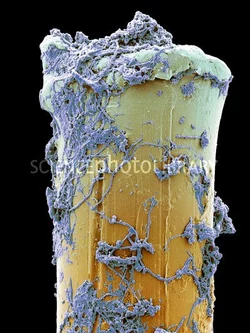 UsedToothbrushBristle.jpg
