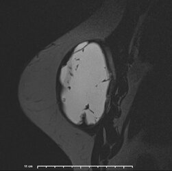 image-Patient_ 7].jpg