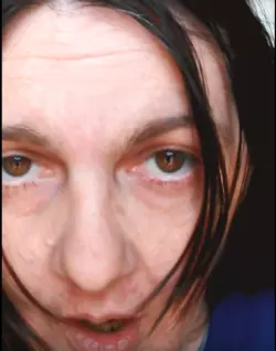 Smoothskin.png