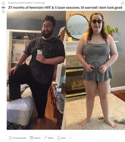27-months-of-feminizin-HRT-5-laser-sessions-lil-worried-i-dont-look-good-transtimelines.png