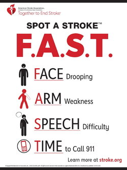 DS15972-Stroke-FAST-Poster_3.jpg