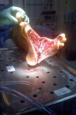 foot-split-half-lengthwise-boat-propeller-1338308833-500x750.jpg