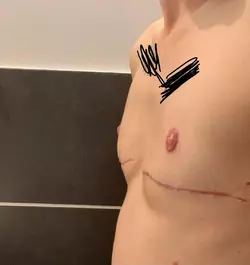 feeling-bad-still-have-boobs-v0-pc09u0pt2f9f1.webp