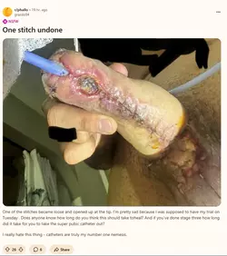 Lamprey_worse0.webp