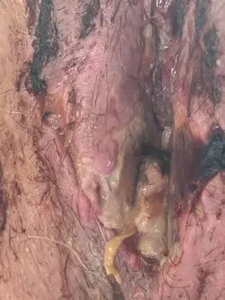 discoloration-or-necrosis-v0-kutmtlxdl0nf1.webp
