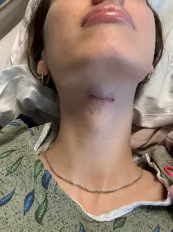 tracheal-shave-v0-vxx8bmluvcof1.webp