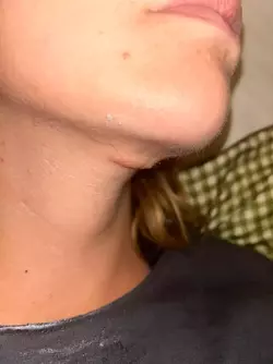 concerned-about-scar-tracheal-shave-v0-z1fntlyrmsrf1.webp