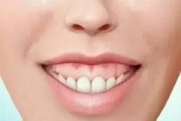 fuckme2.webp