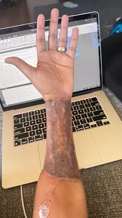 arm-update-v0-tm2jtbakgisf1.webp