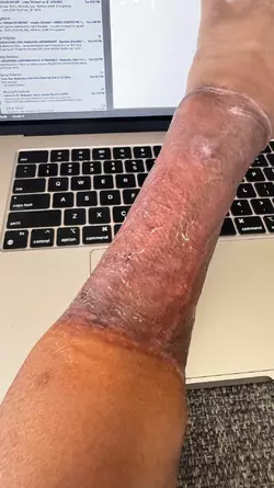 arm-update-v0-2h5drz9kgisf1.webp