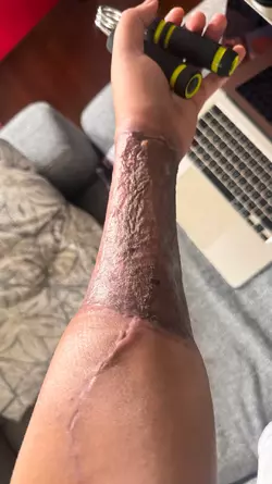 arm-update-v0-fjfy13akgisf1.webp