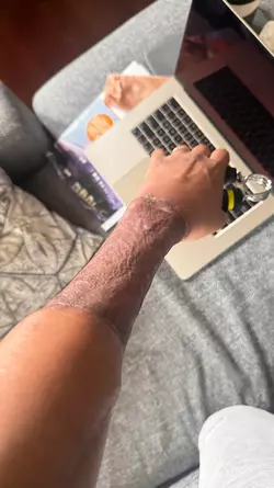 arm-update-v0-o9qij4akgisf1.webp