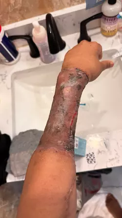 arm-update-v0-ogfj1z9kgisf1.webp